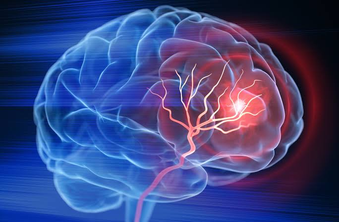 jakarta stroke si momok menakutkan yang tak pandang bulu terus menunjukkan index
