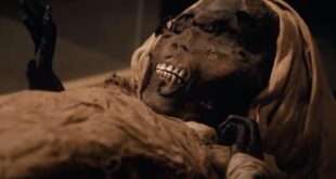 asal usul kawat gigi ternyata berasal dari zaman firaun ini buktinya index