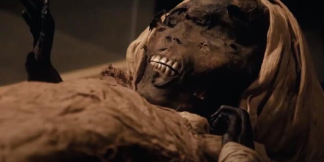 asal usul kawat gigi ternyata berasal dari zaman firaun ini buktinya index