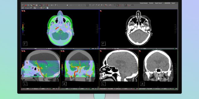 apple studio display xdr now fda cleared for diagnostic radiology use index
