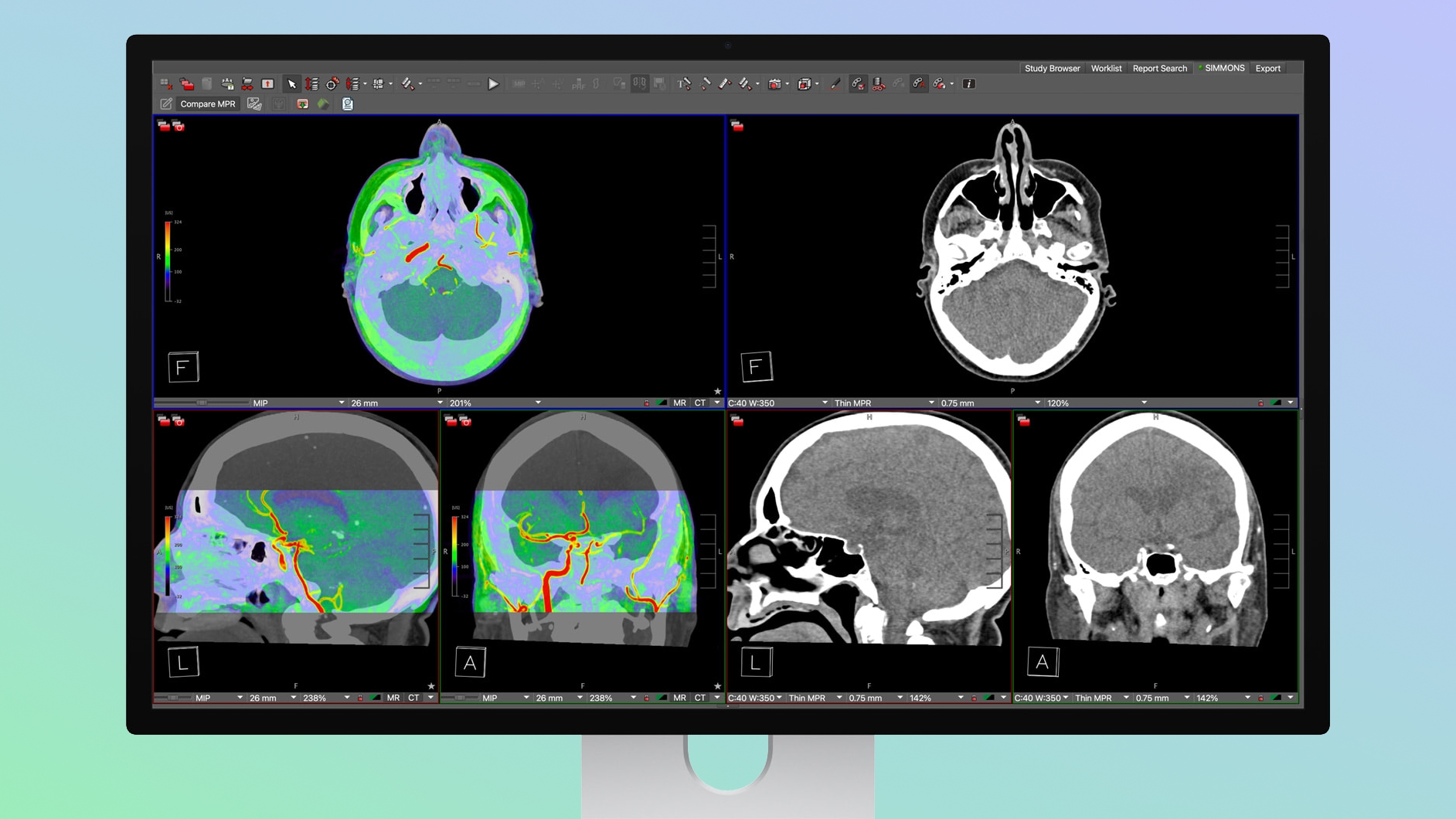 apple studio display xdr now fda cleared for diagnostic radiology use index